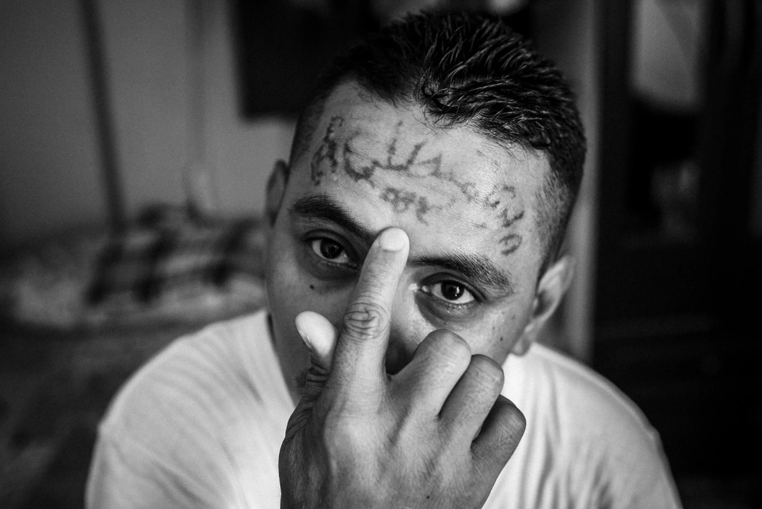 NADÈGE MAZARS | www.nadegemazars.com | @nadege_mazars Jose Rolando, a former gang member, shows his tattoos being erased. He followed 34 laser sessions to remove the signs of this former belonging to the 18 gang in El Salvador.