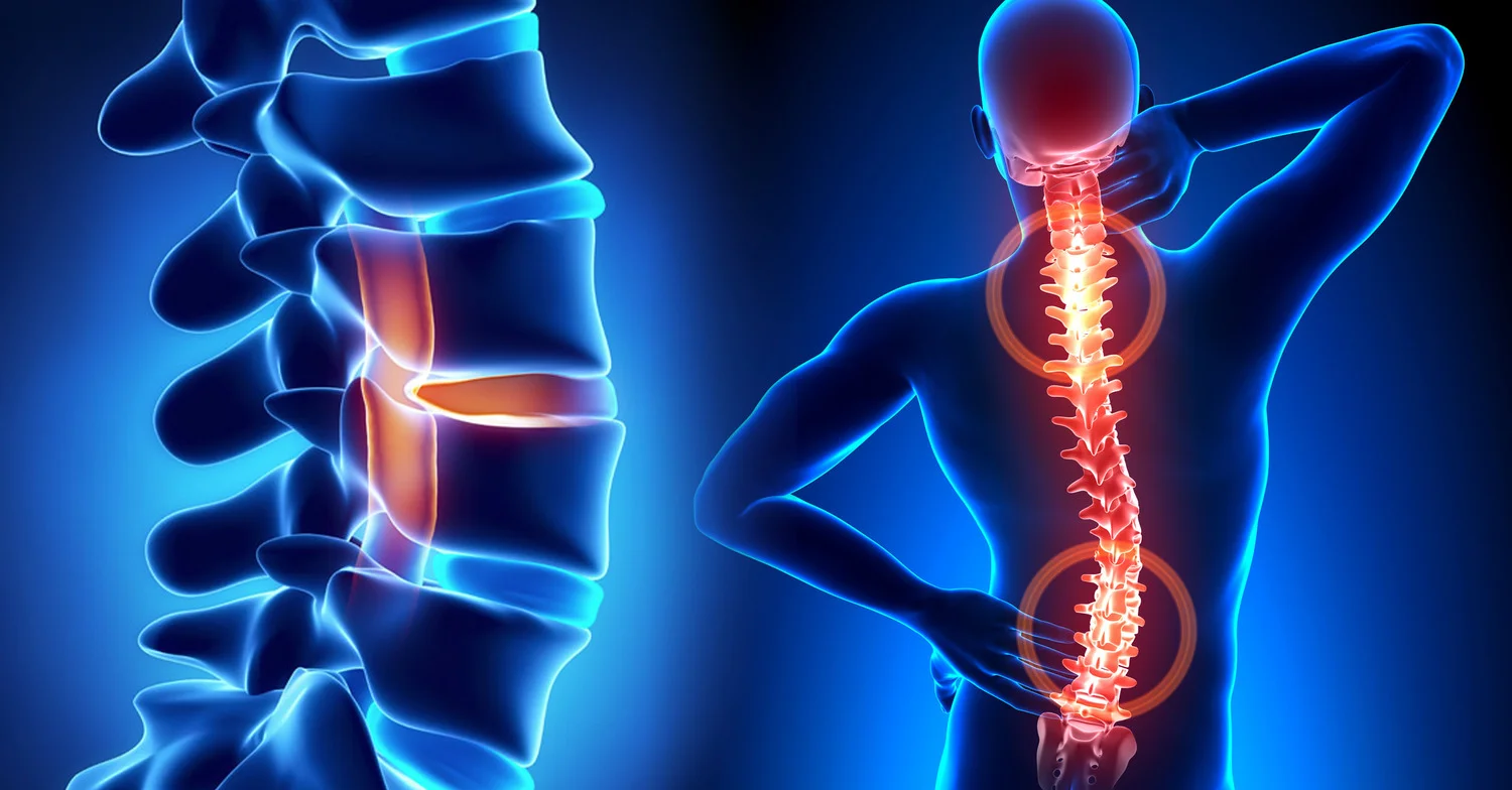spine.jpg