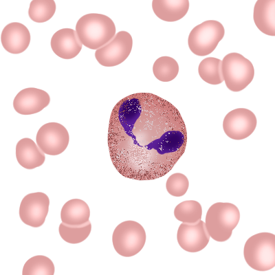 Figure 1: Eosinophil. Wikipedia Commons.