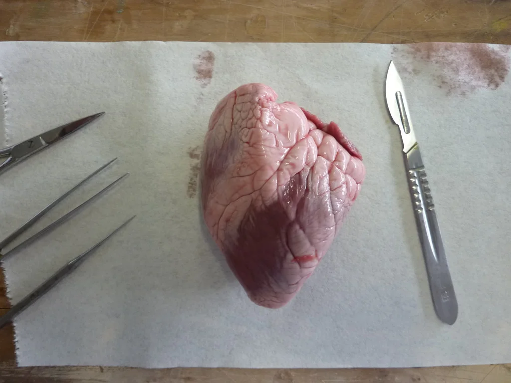 Heart Dissection