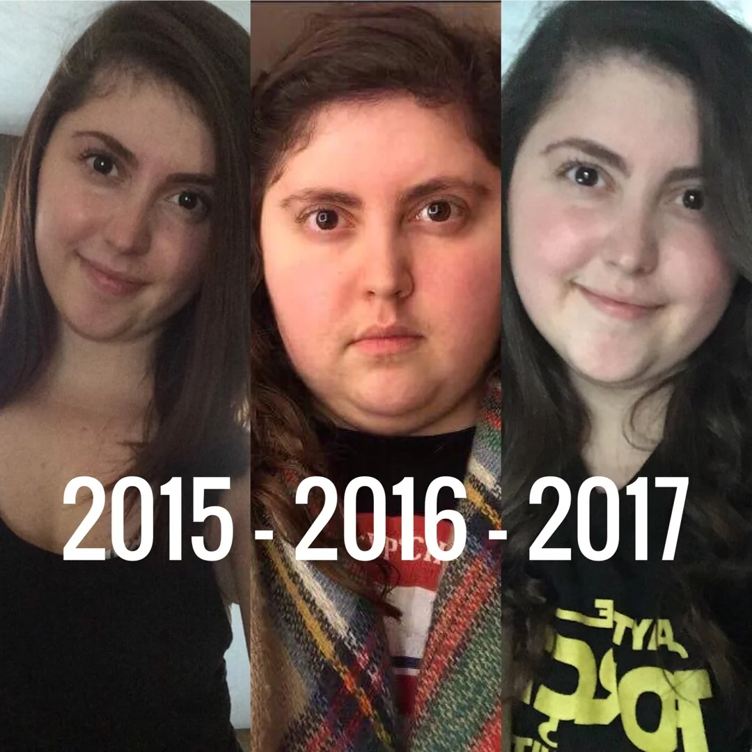 (Morning of surgery January 2017-April 2017)