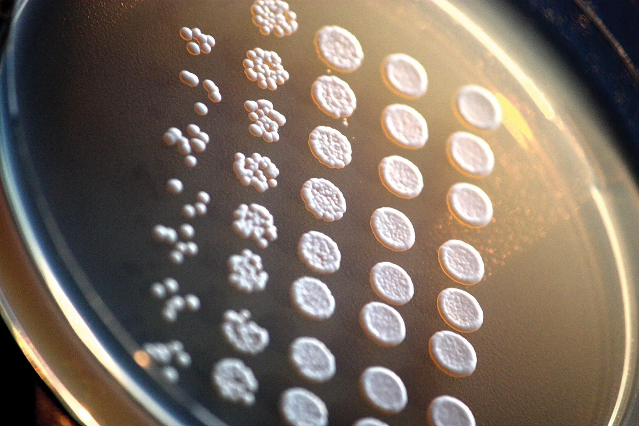 These baker’s yeast cells have genetic similarities to human cells. Credit: Rainis Venta