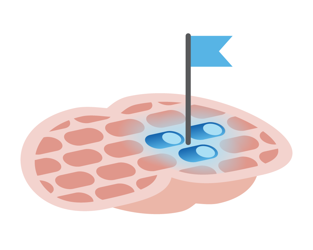 optogenetics infographic_FOR WEB-04.png