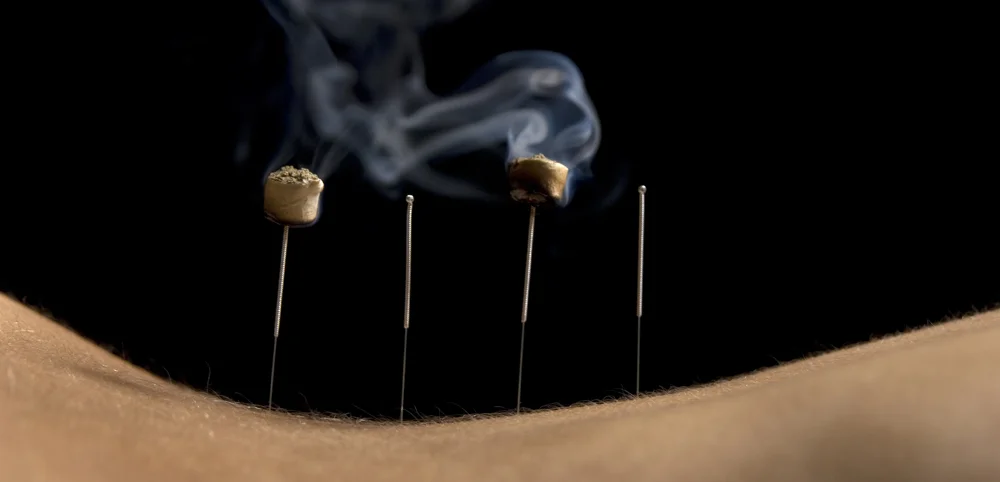 moxibustion.jpg