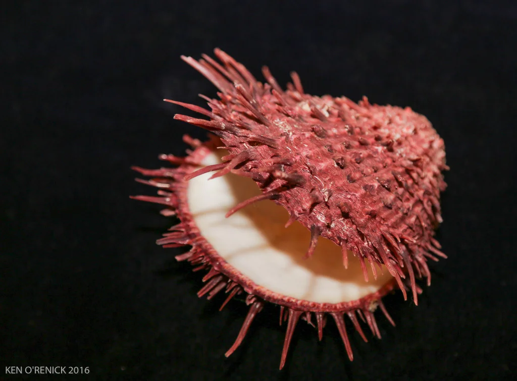 SPONDRYLUS