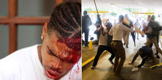 Deandre Harris, during and after attacks by white supremacists. (google.com)