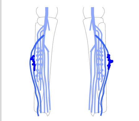 Venous Diagrams