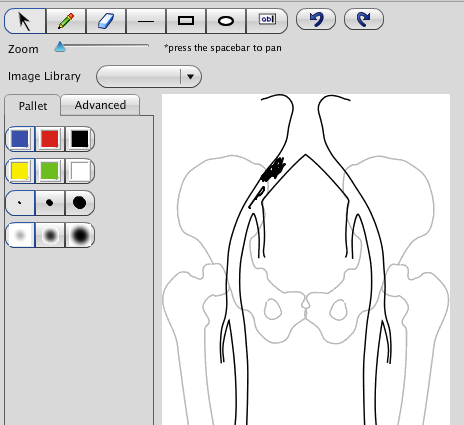 Leg Artery Drawing