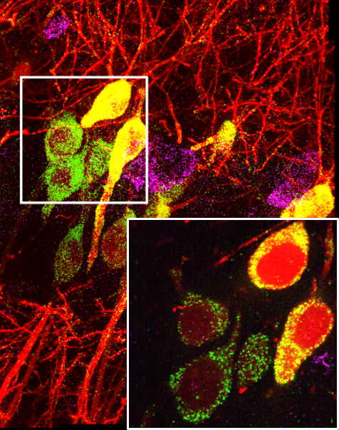 The Chen lab - in situ transcriptomics