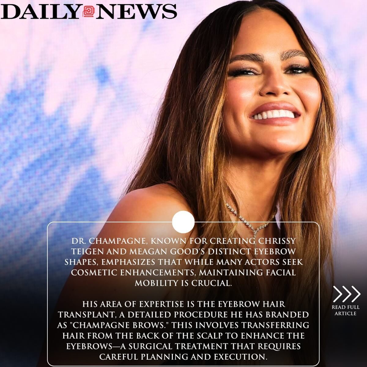 &ldquo;Dr. Champagne, known for creating Chrissy Teigen and Meagan Good&rsquo;s distinct eyebrow shapes, emphasizes that while many actors seek cosmetic enhancements, maintaining facial mobility is crucial. &ldquo;The goal should be to have lines but
