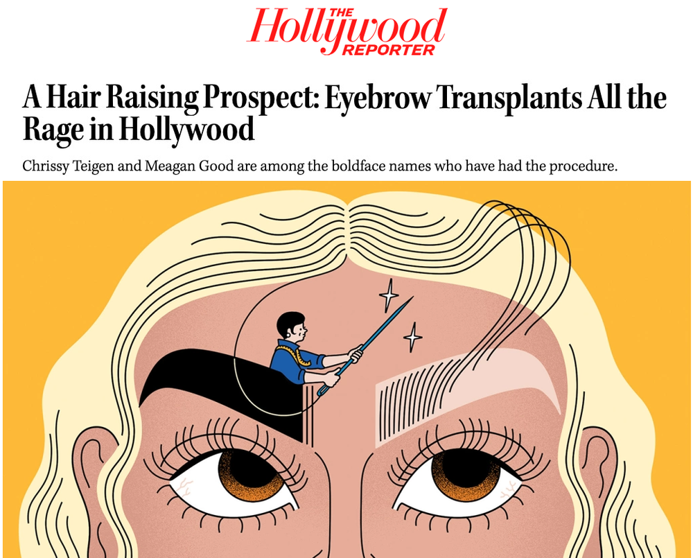 A Hair Raising Prospect Eyebrow Transplants All The Rage In Hollywood Plastic Surgeon Beverly Hills Ca Dr Jason Champagne