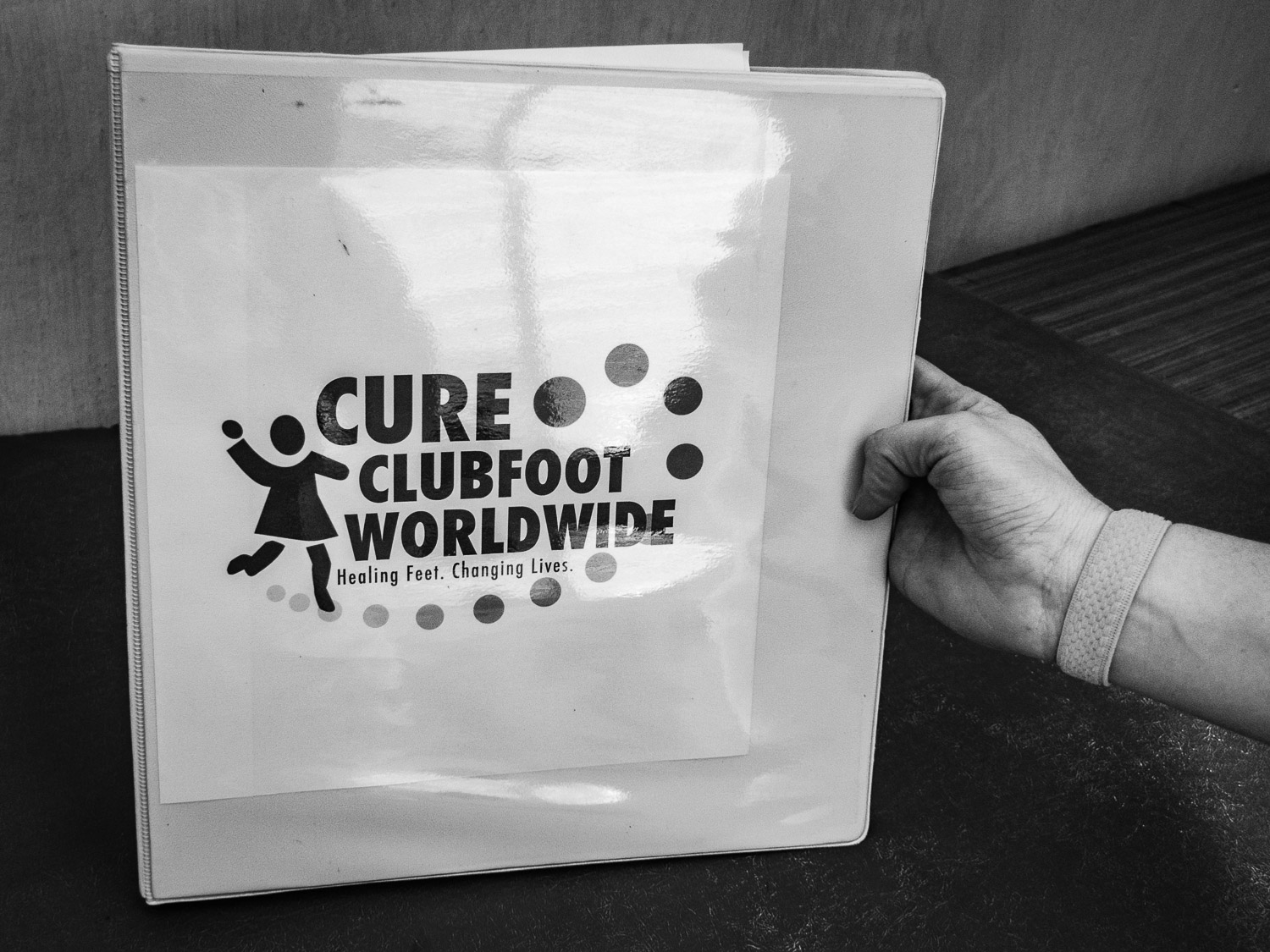  Data was reported to the worldwide CURE clubfoot program. 