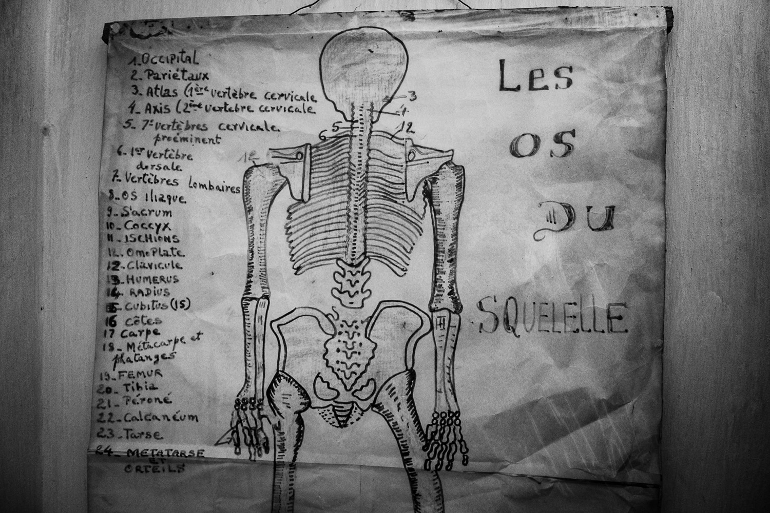  Anatomy chart in clinic. 