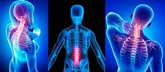 Neck Pain, Headaches,Mid Back Pain, and Low Back Pain