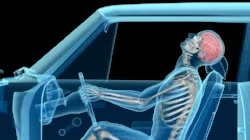 Whiplash as well as many other car accident injuries