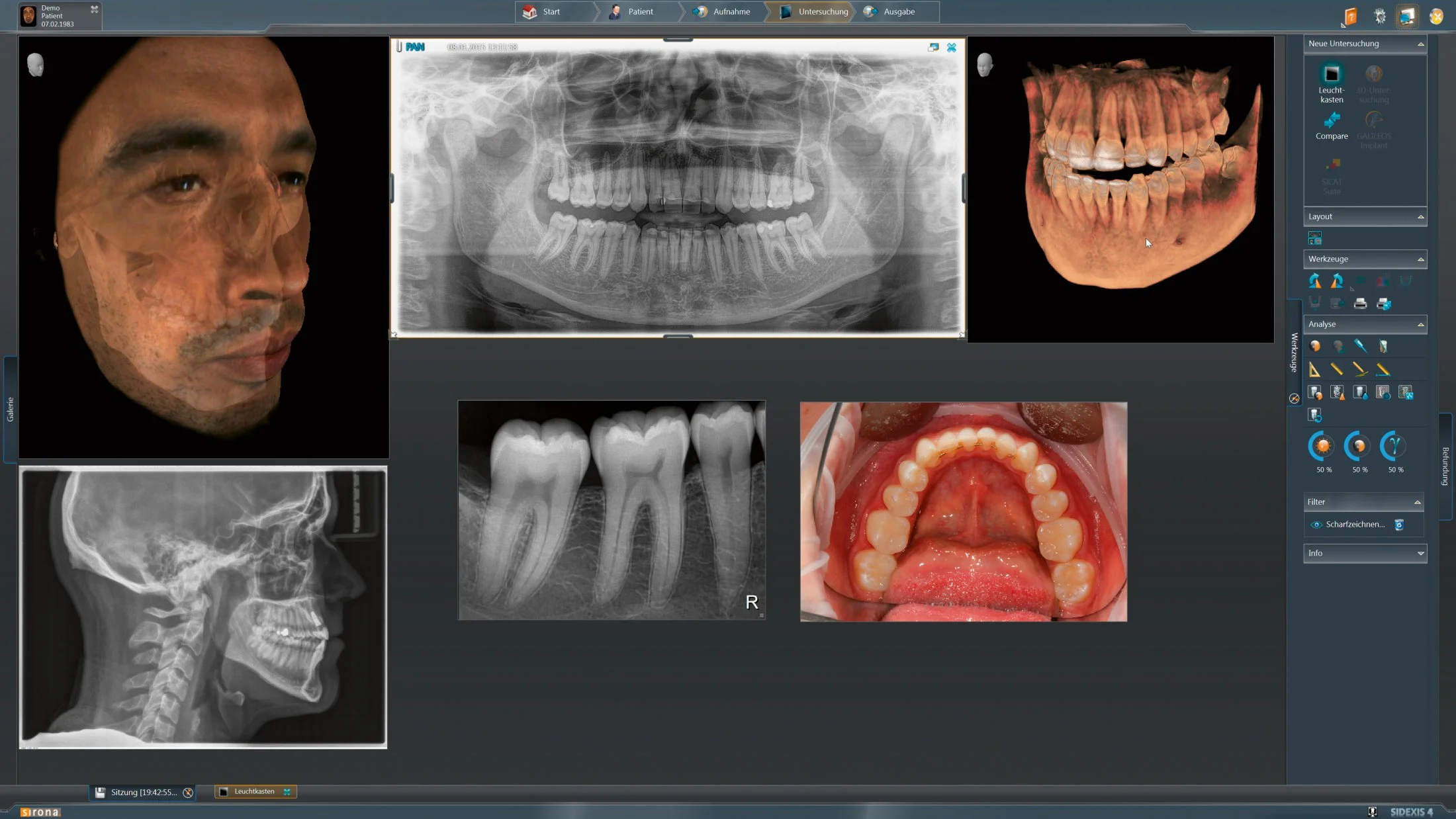 Xray 1.jpg