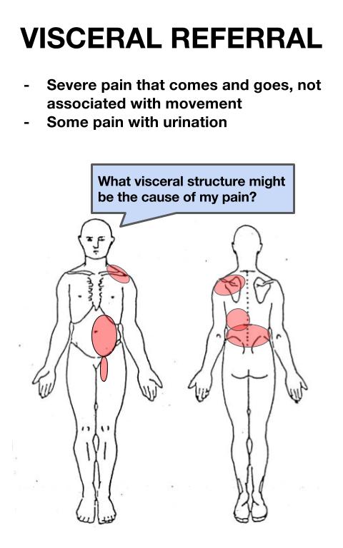 Visceral Referral Patterns Chart