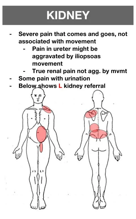 Organ Referred Pain Chart