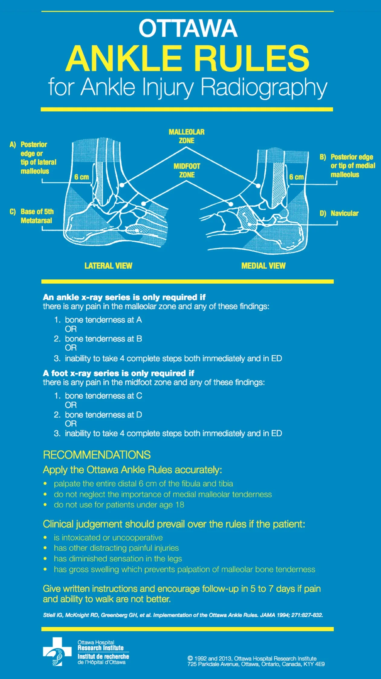 Ottawa Ankle Rules James McAfee PT DPT Ottawa Ankle Rules James McAfee PT DPT