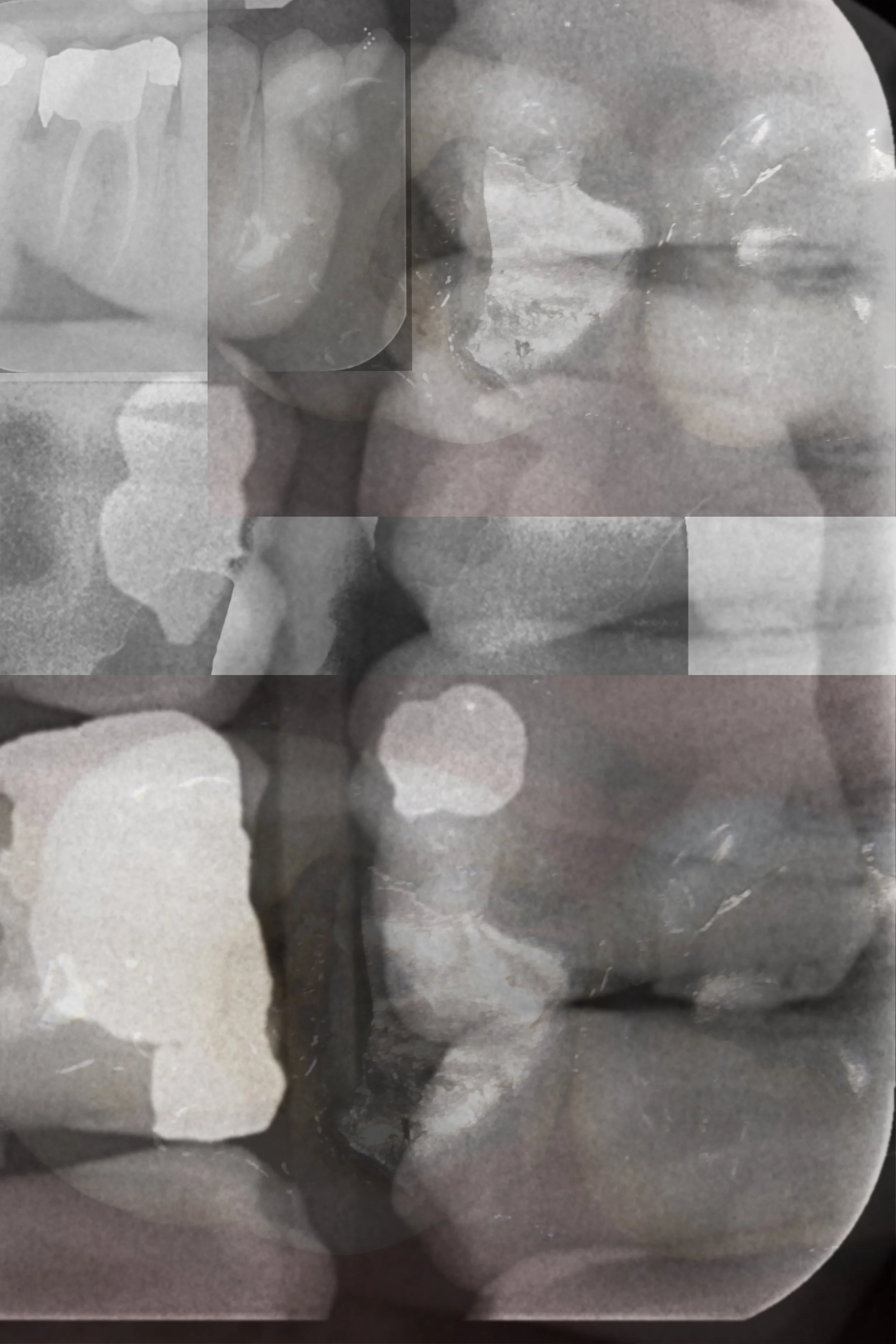 Teeth.jpg