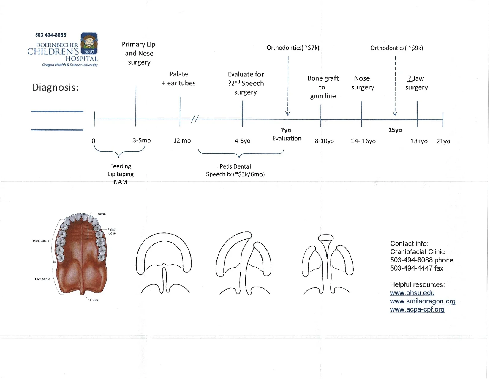 Cleft Surgery Timeline.jpg