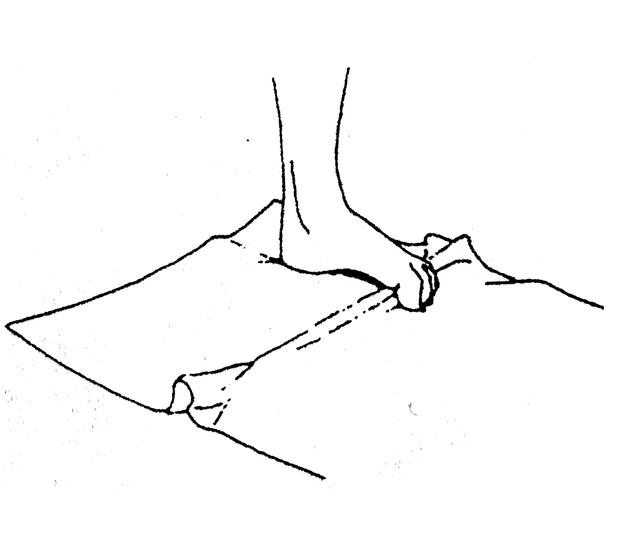 Place your foot on a towel on the floor. Slowly curl your toes in, pulling the towel towards you. This is to try and strengthen the small muscles in your arch. Repeat for 3 towel lengths. If too easy, put a weight on the far end of the towel.