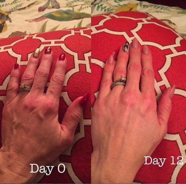Never forget your hands or neck, they are tell tale signs of aging that people often forget! This picture is from just 12 days of using Wake Up &amp; Glow!