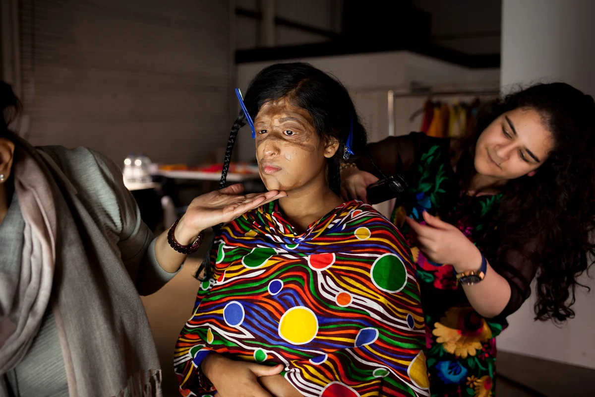 Sonali, 15, had acid thrown on her as a baby. Picture: ActionAid.
