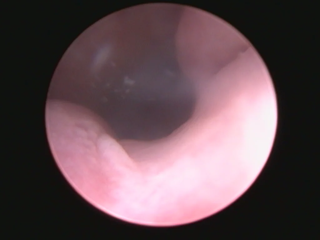 Cystoscopic view of the ureteralvesicular junctions in a female dog