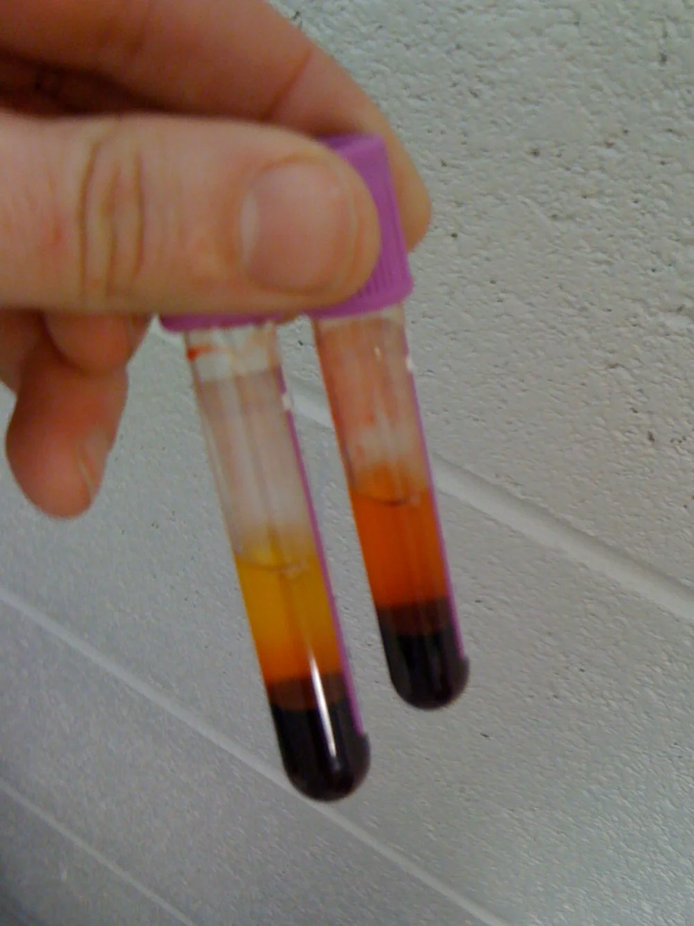 What Causes High Protein Levels In Dogs