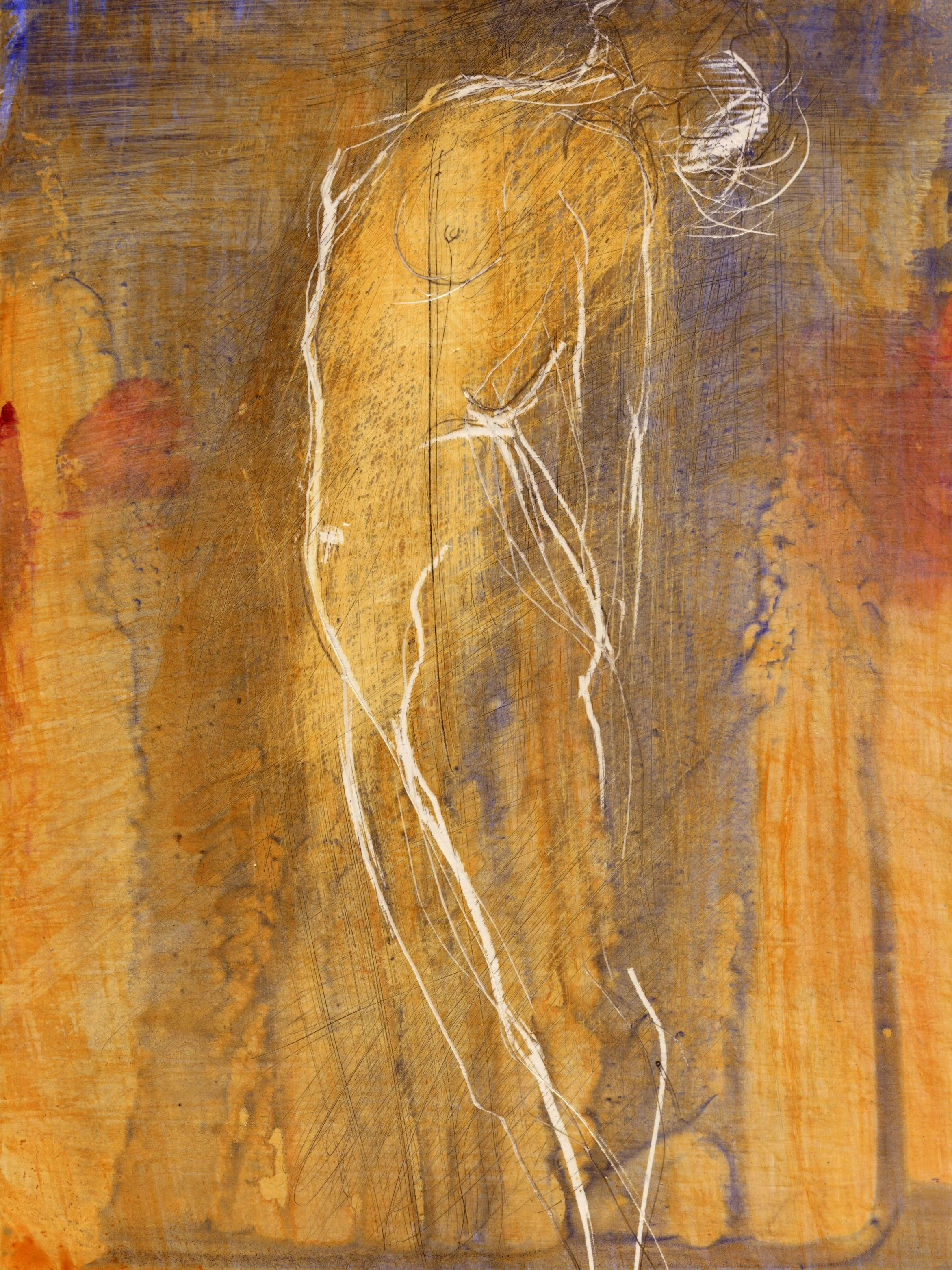 figure 1 (sold)