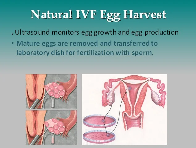 Natural-IVF-Egg-Harvest-West-Coast-Fertility-Centers-Orange-County.jpg