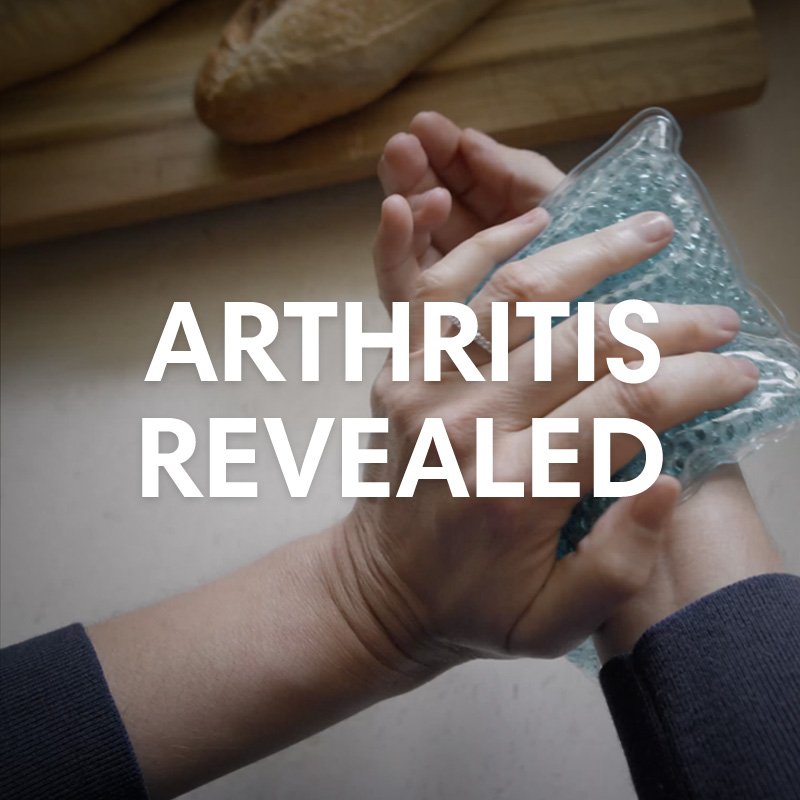 Arthritis Revealed Campaign