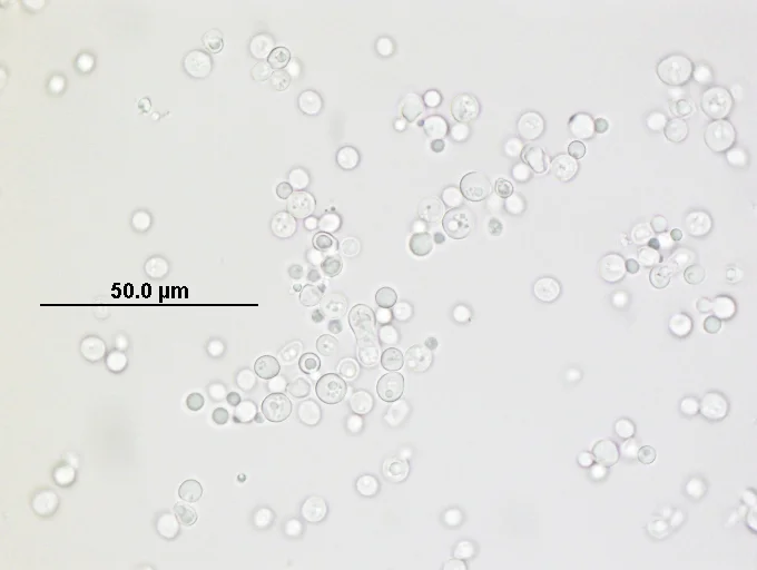 A microscopic view of some of the yeast behind Wasp Beer.