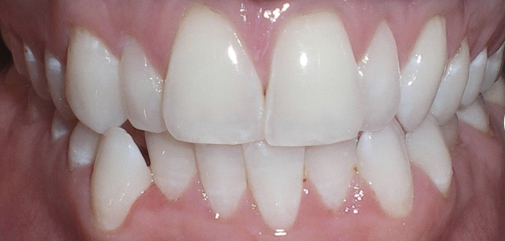 teeth1.png