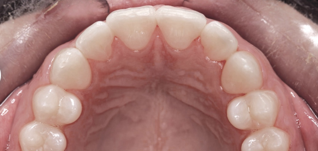 teeth2.png