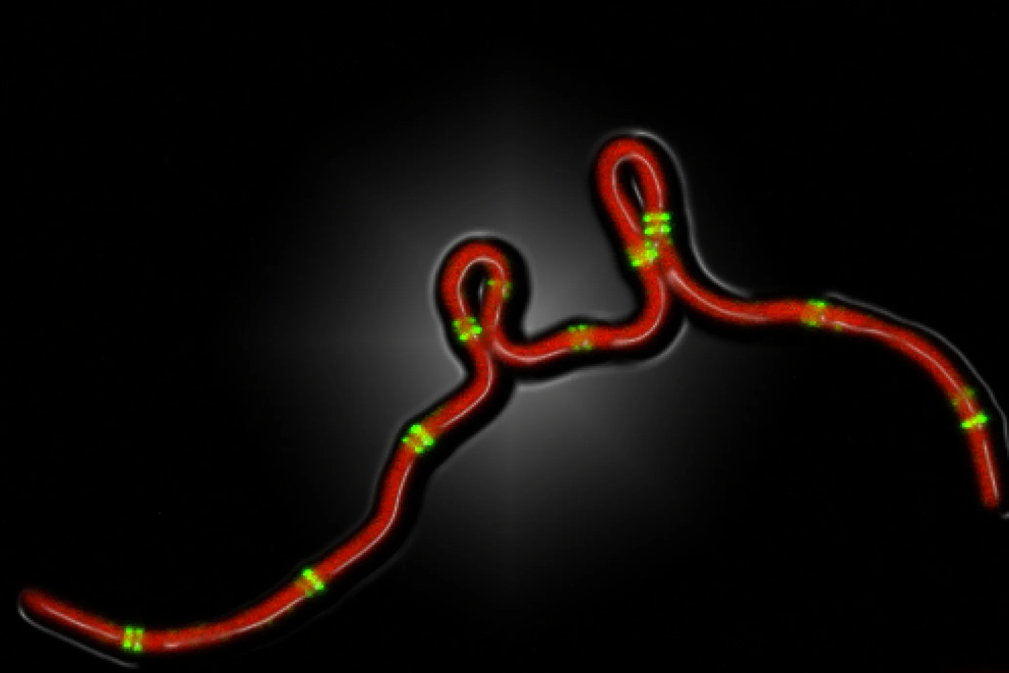 Fig5_FtsZ-GFP Ceph plastic.jpg