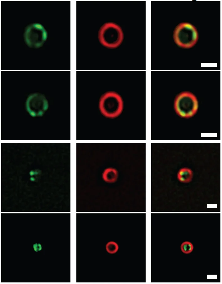 Figure 2. Images of the divisome ring as it constricts an E. coli cell. The FtsZ protein is labelled green and FtsN is labelled red. 