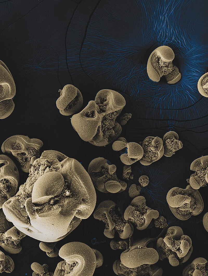 Metal-Eating Microbes