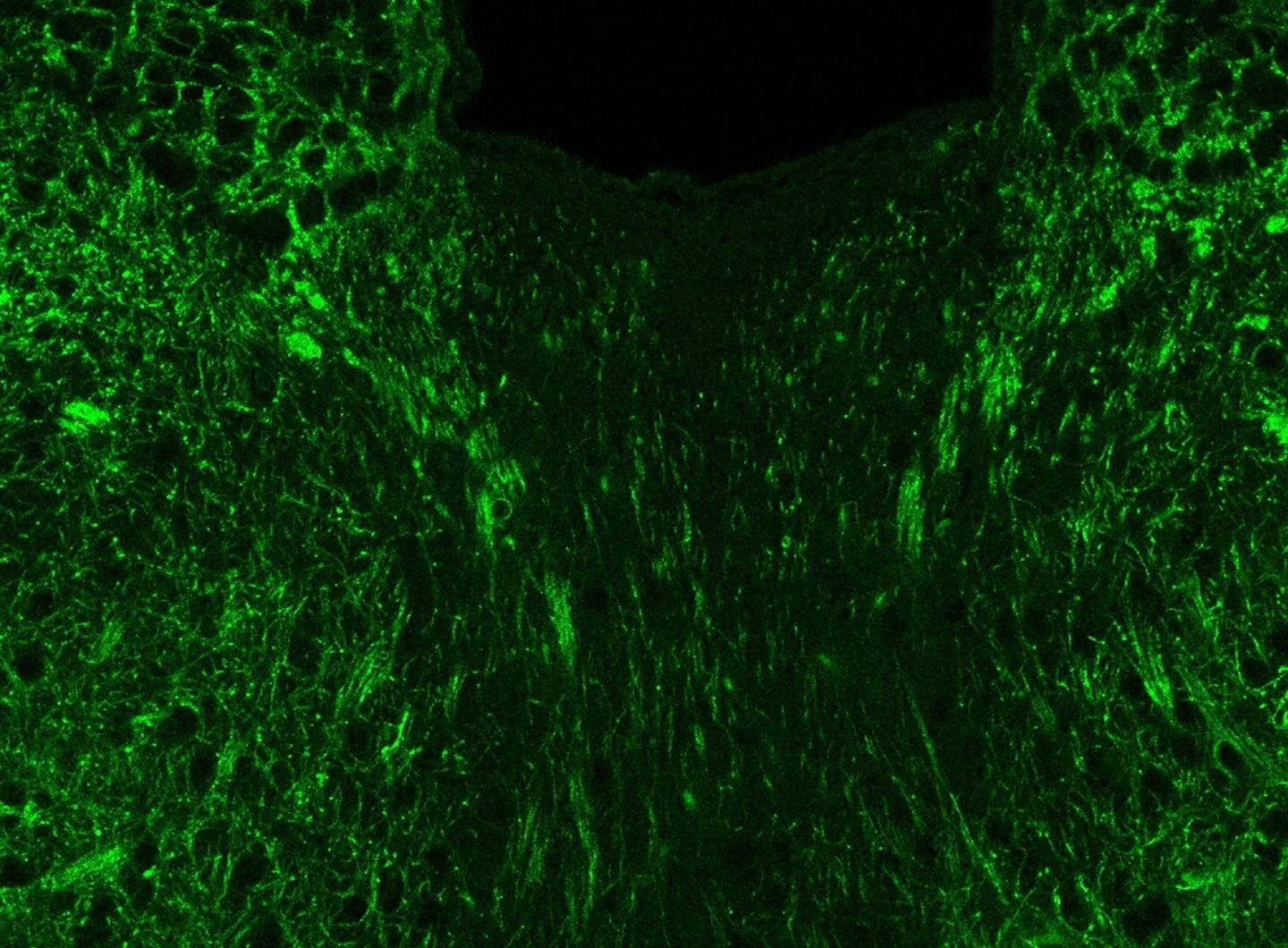  A Microbial Compound in the Gut Leads to Anxious Behaviors in Mice 