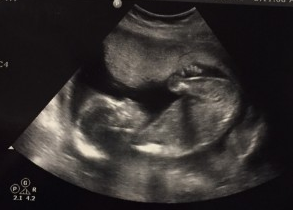 Introducing our little.......