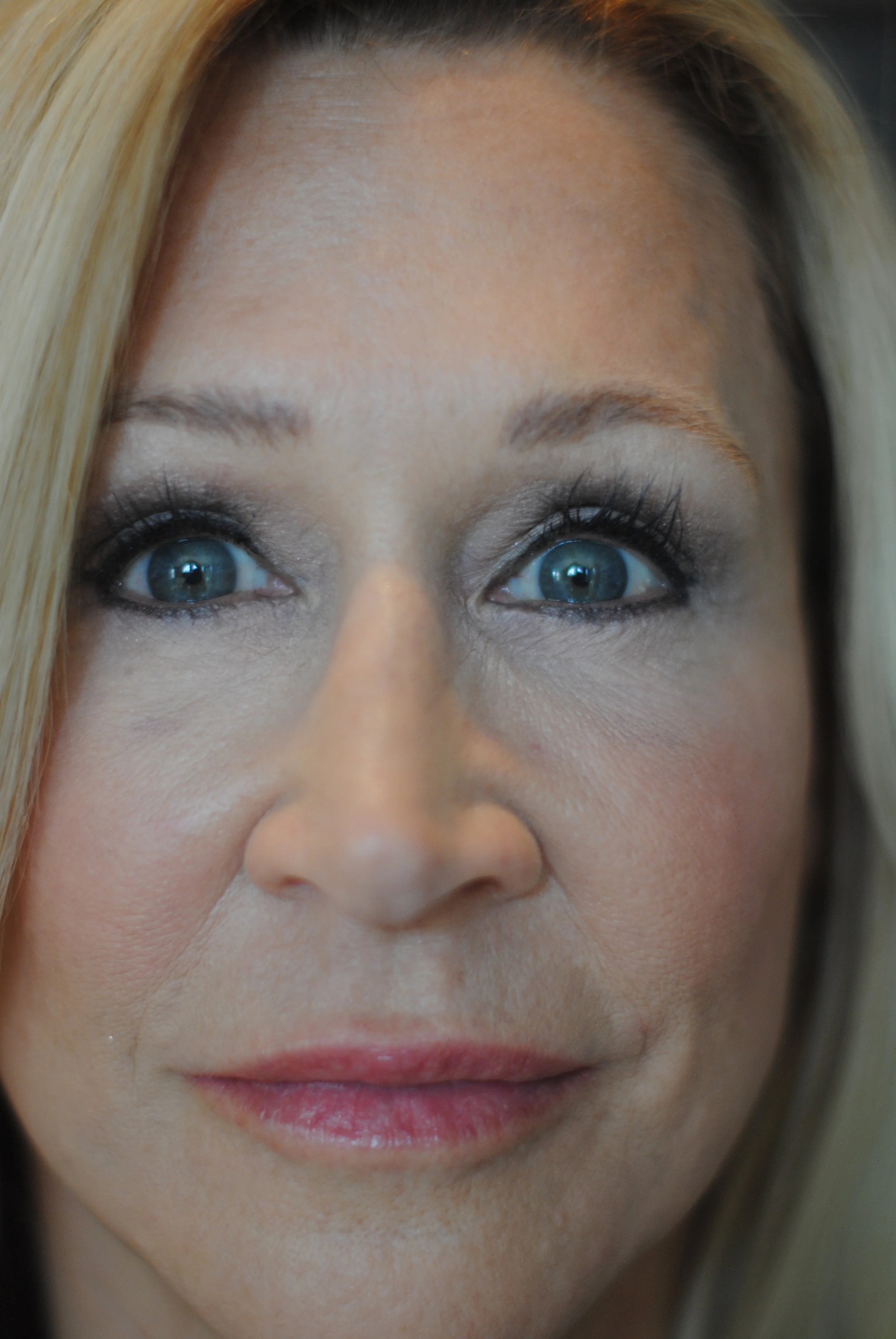 Eye Surgery
