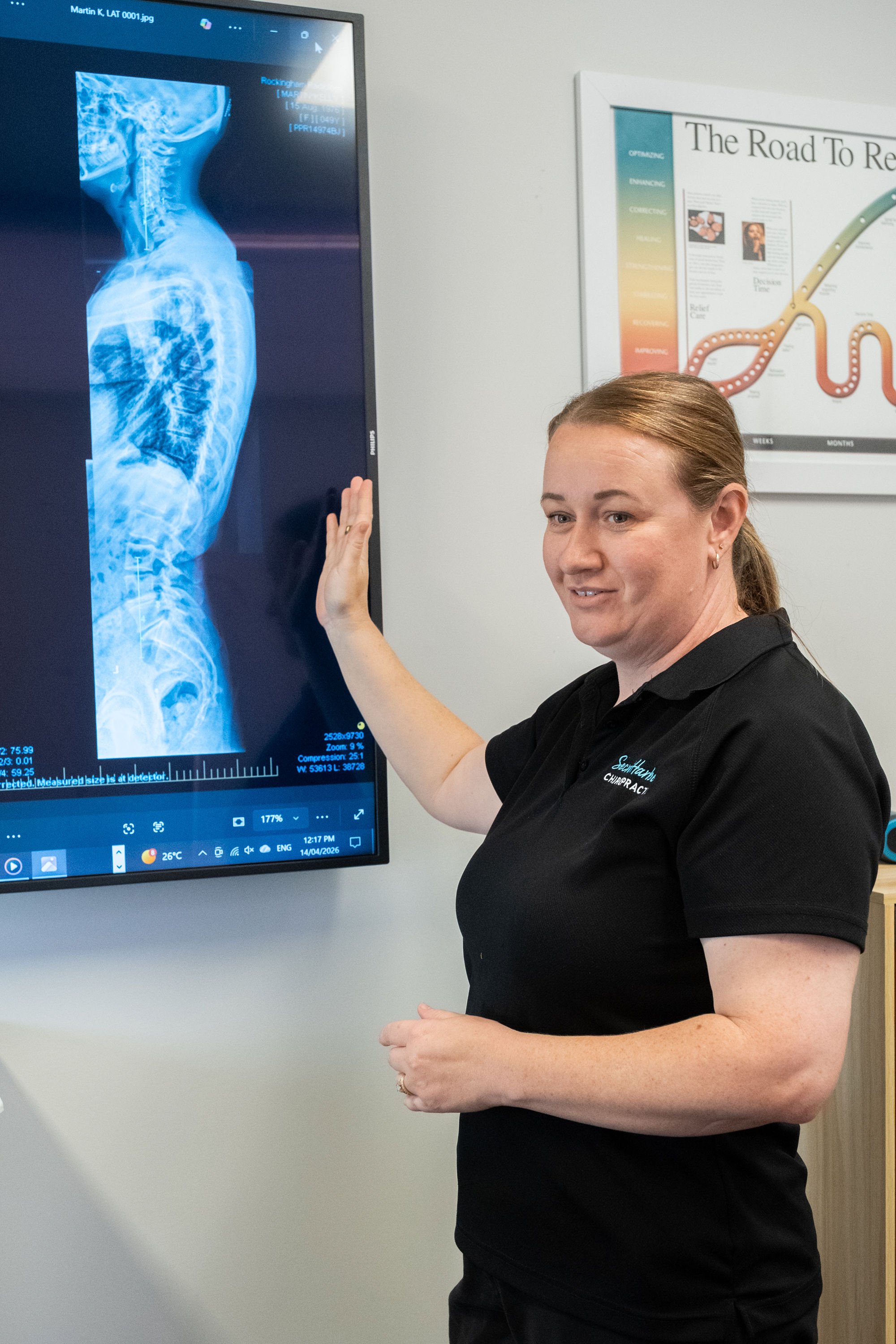 Friendly Chiropractor showing x-rays to client to explain alignment and degeneration
