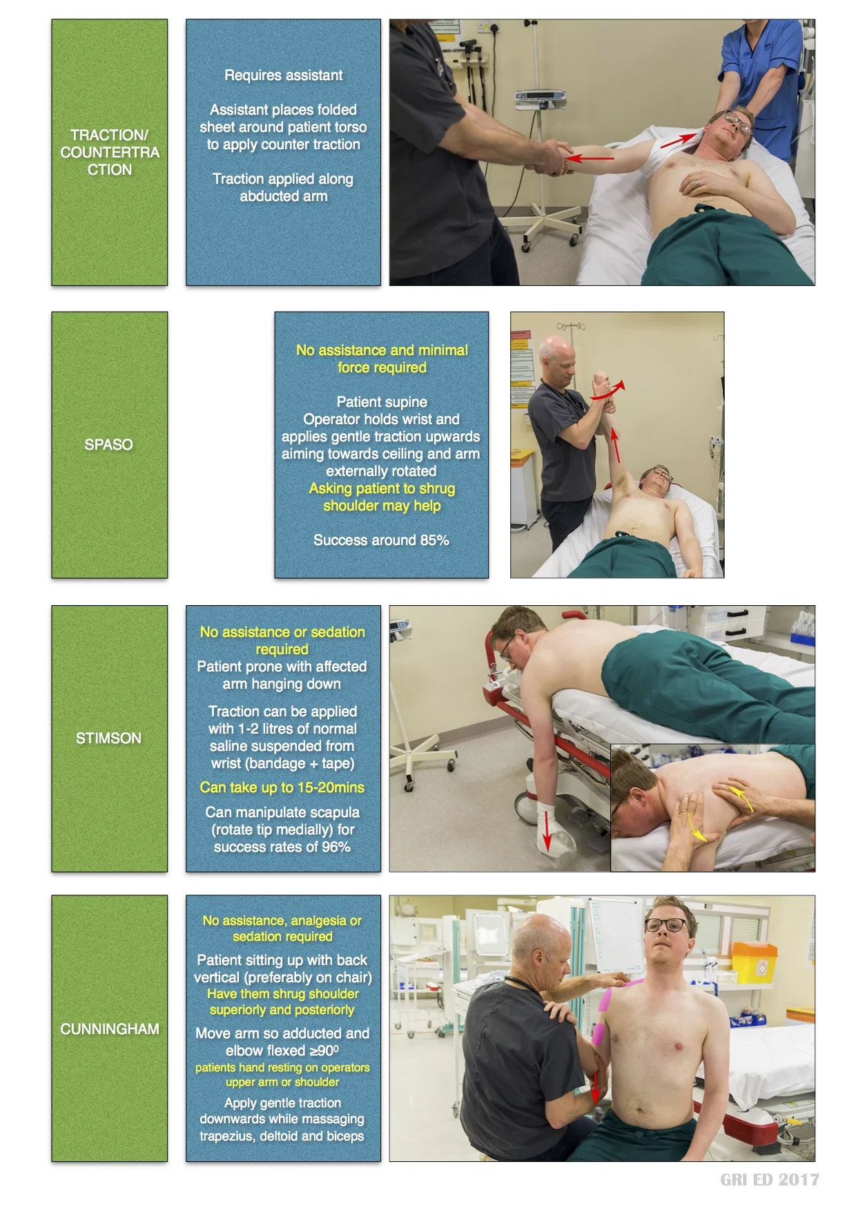 Shoulder Reduction Methodes st mungo's-Shoulder Reduction