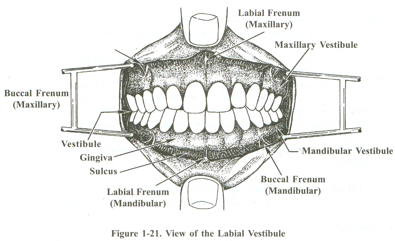 Buccal Sulcus.gif