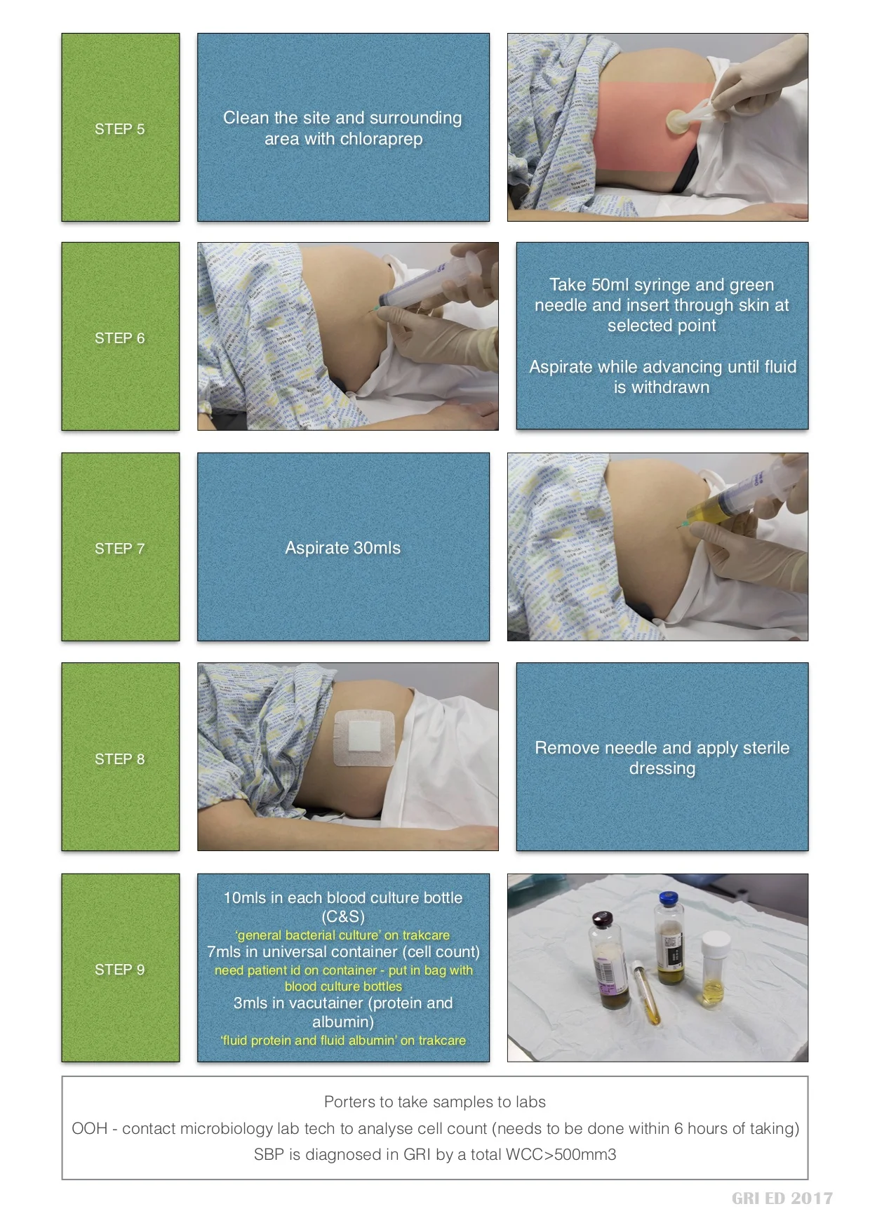 st mungo'sAscitic Tap