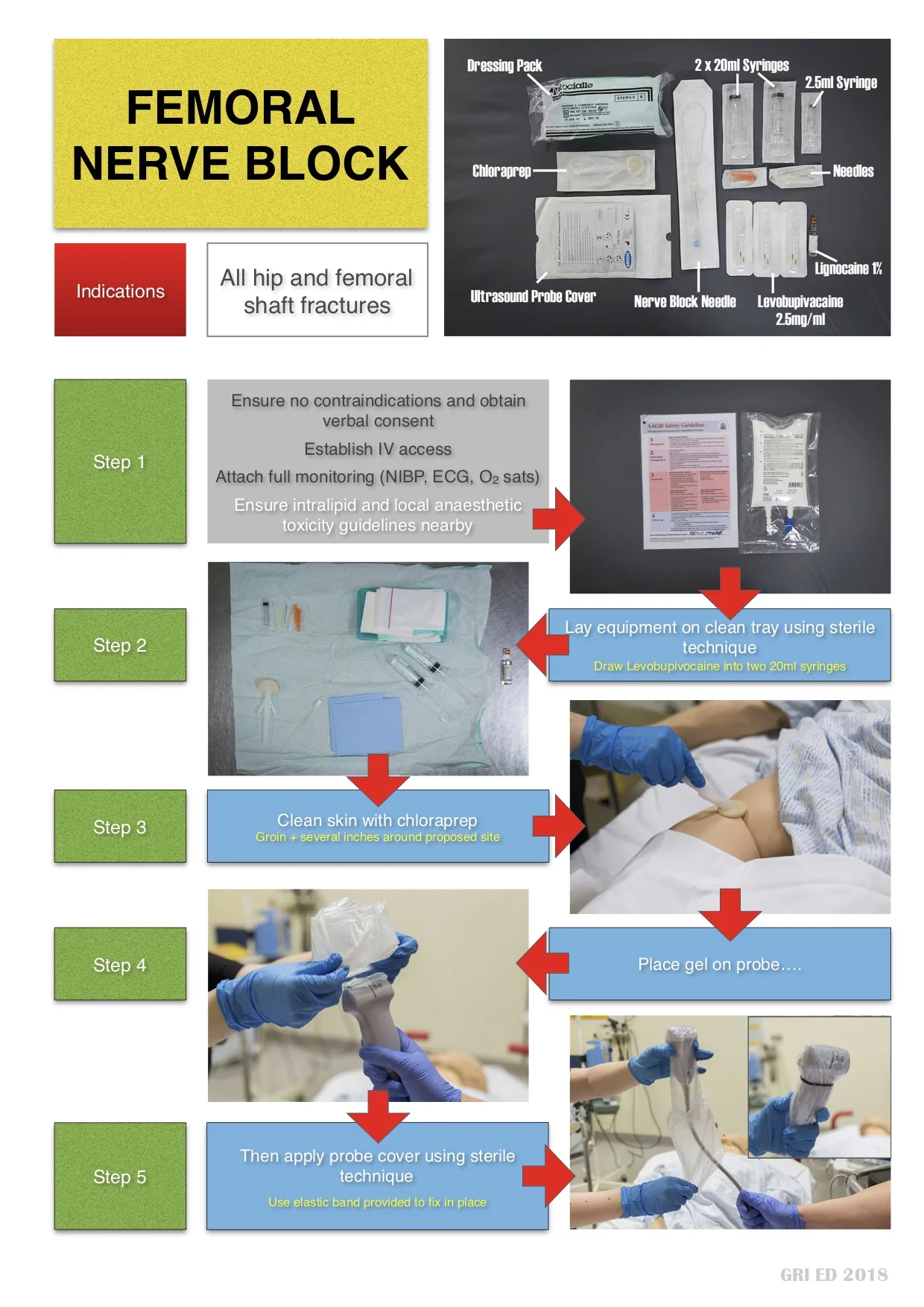 Femoral Nerve Block1.jpg