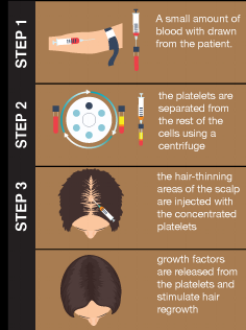 Procedure-Steps.png