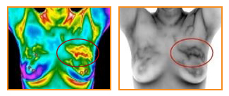 breast thermography cost palm beach gardens fl