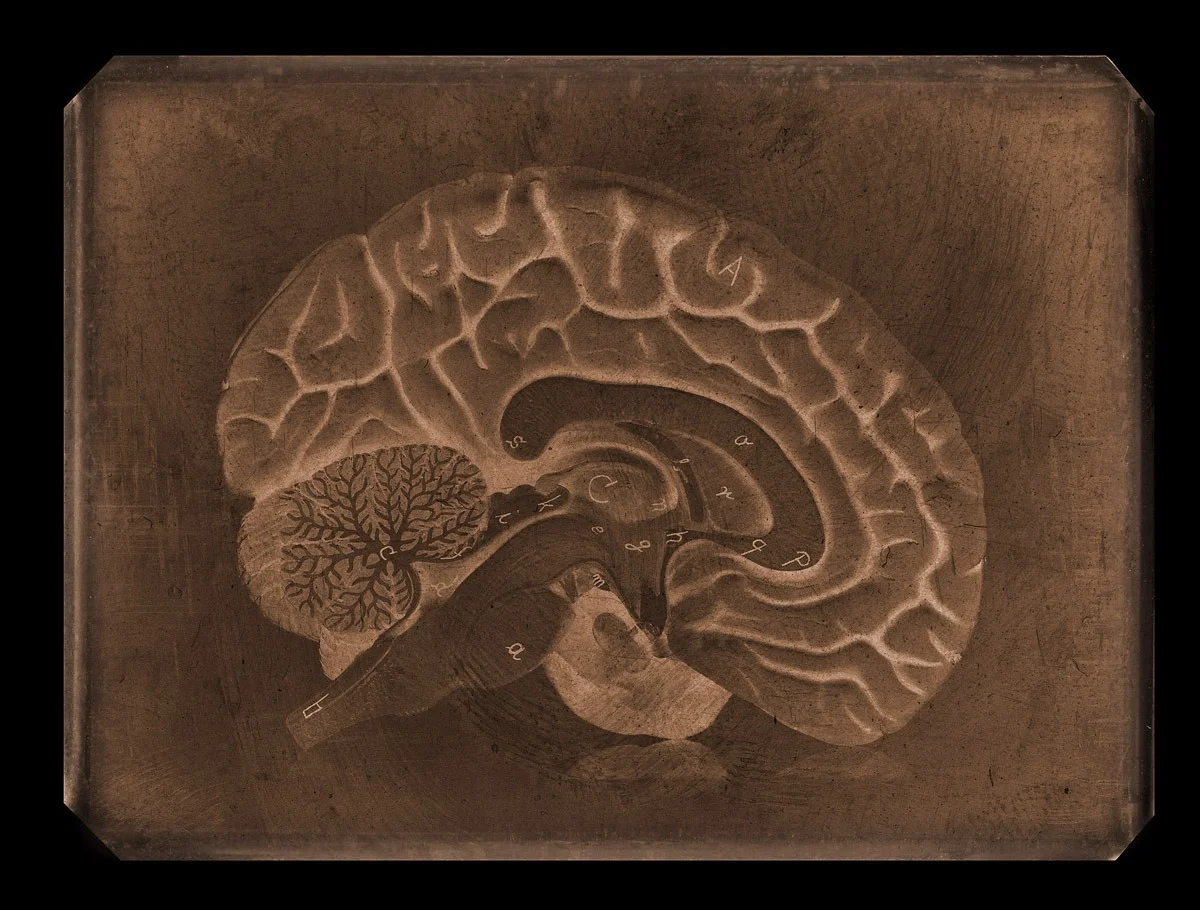Brain Tin